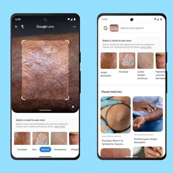 Google Lens Skin Identification